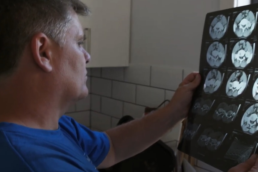 Mature aged man looks at an old xray in his kitchen.