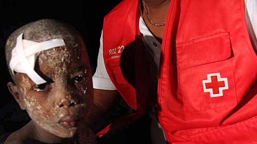 An earthquake survivor receives first aid in a shanty town on the outskirts of Port-au-Prince