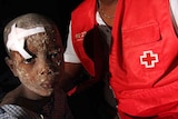 An earthquake survivor receives first aid in a shanty town on the outskirts of Port-au-Prince