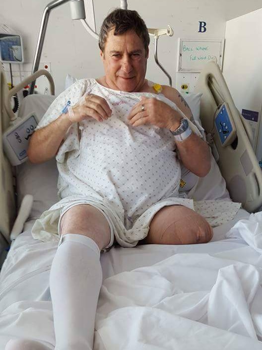 Wayne Ball lies in a hospital bed after his leg amputation.