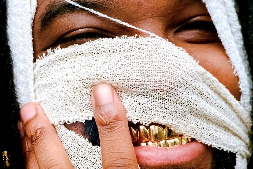 Album cover featuring a man with bandages on his face and gold teeth