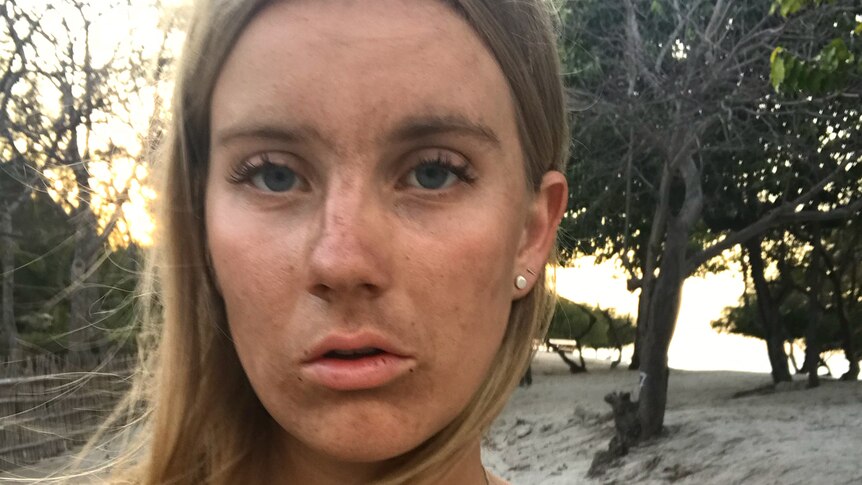 An image of Sydney woman Emily Phillips with a dirty face after being on the island during an earthquake