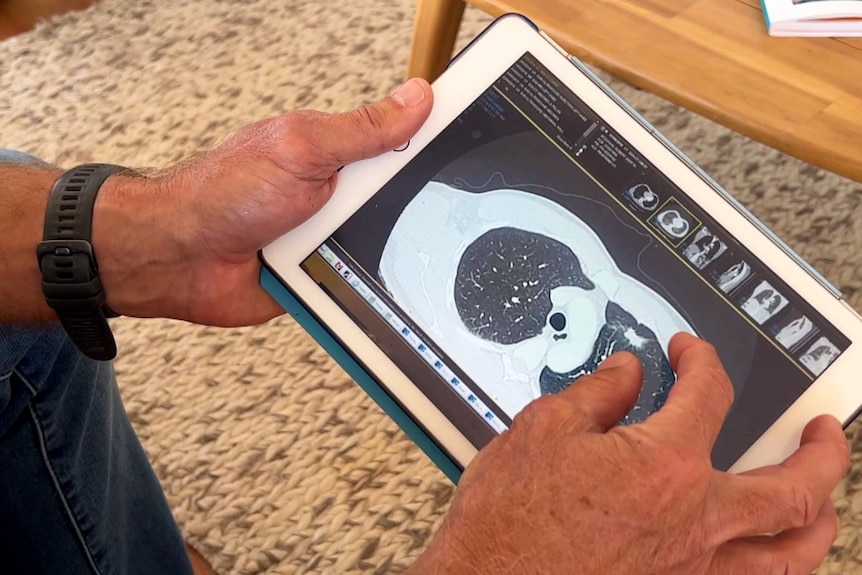 A person holds a device showing a cancer scan