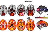 Brain scans show effects under placebo and LSD