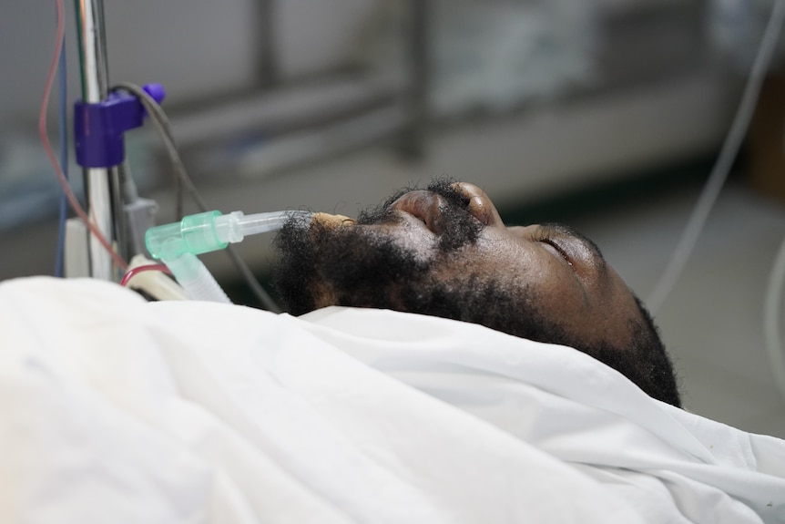 A man under anaesthetic lays on an operating table with his eyes closed, a breathing tube in his mouth