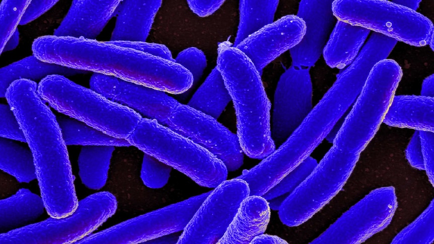 A colorised scanning electron micrograph of Escherichia coli