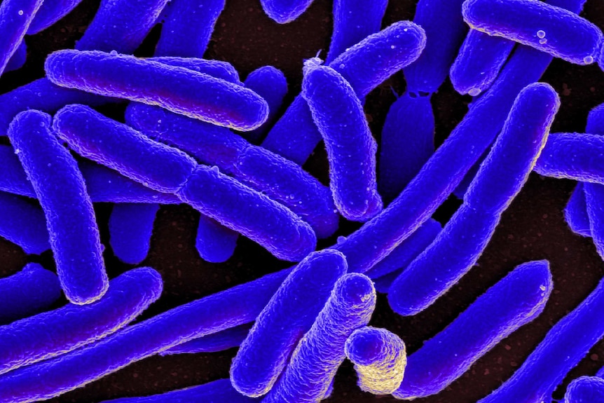 A colorised scanning electron micrograph of Escherichia coli