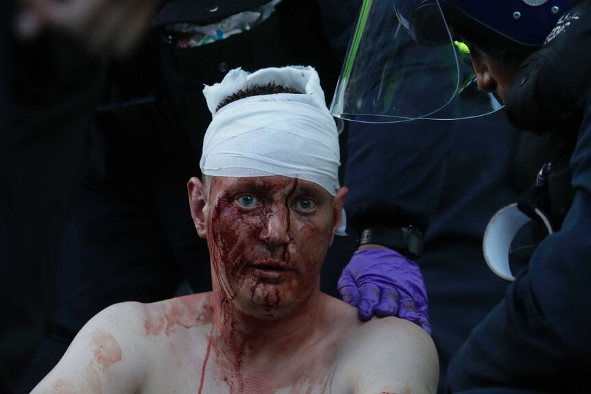 British police paramedics tend to a member of a far-right group whose face is covered in blood.