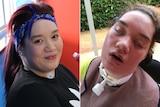 A montage of a young woman wearing a blue bandanna and smiling, and the same woman unconscious with a tube in her throat.