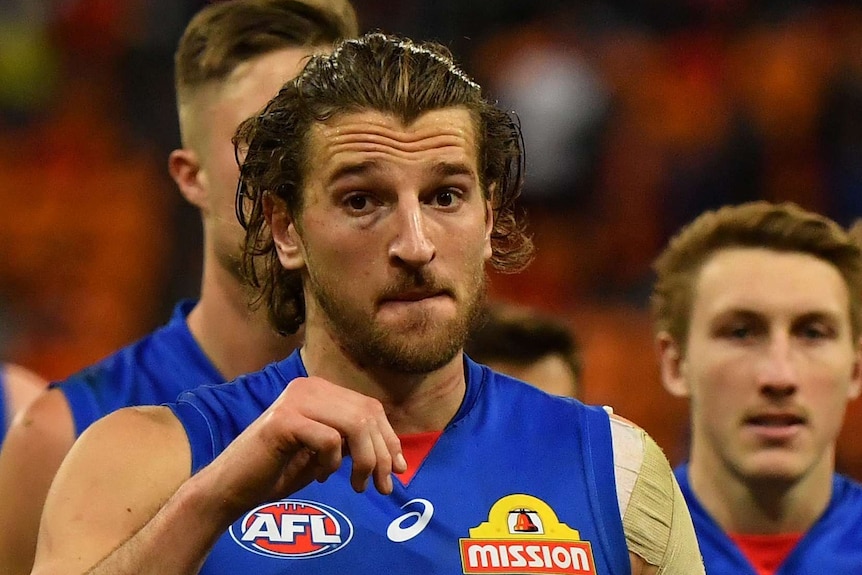 The bruising to Marcus Bontempelli's eye after Saturday's game.