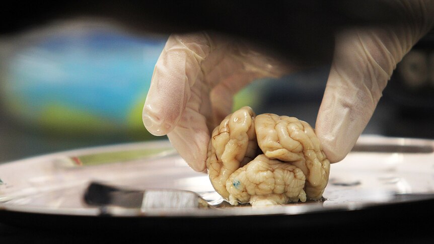 A gloved hand touching a small brain on a metal plate. The brain is about the size of a small plum.