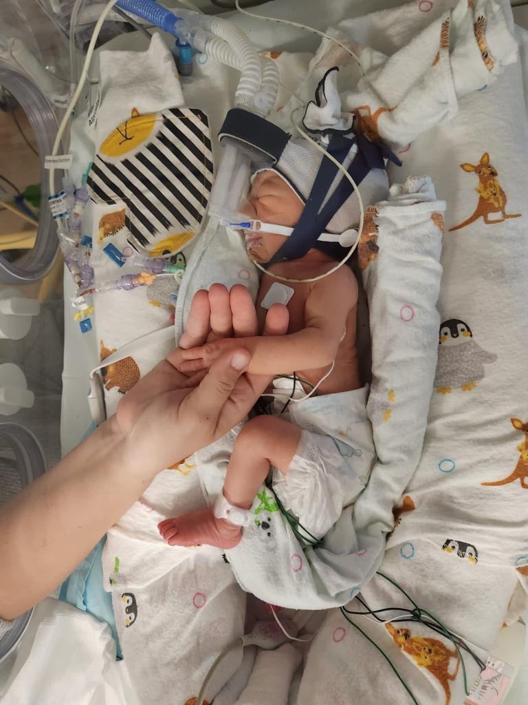 Baby Menasheh is connected to tubes and a breathing aid as he lays in a cot