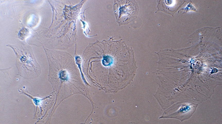 Blue cells on a grey background. The cells are big and flat, with enlarged nuclei.