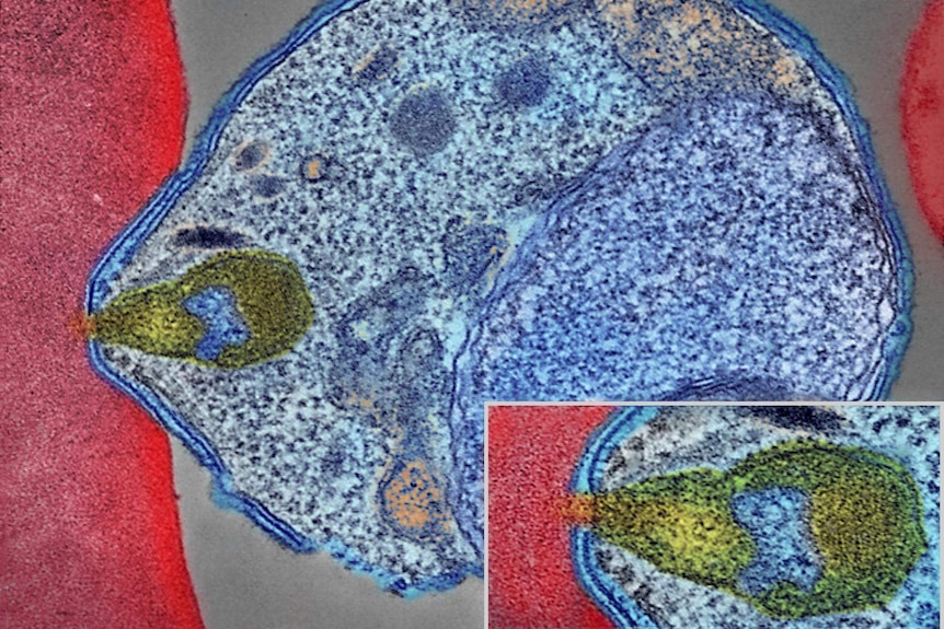 Colorized electron micrograph showing malaria parasite (right, blue) attaching to a human red blood cell.