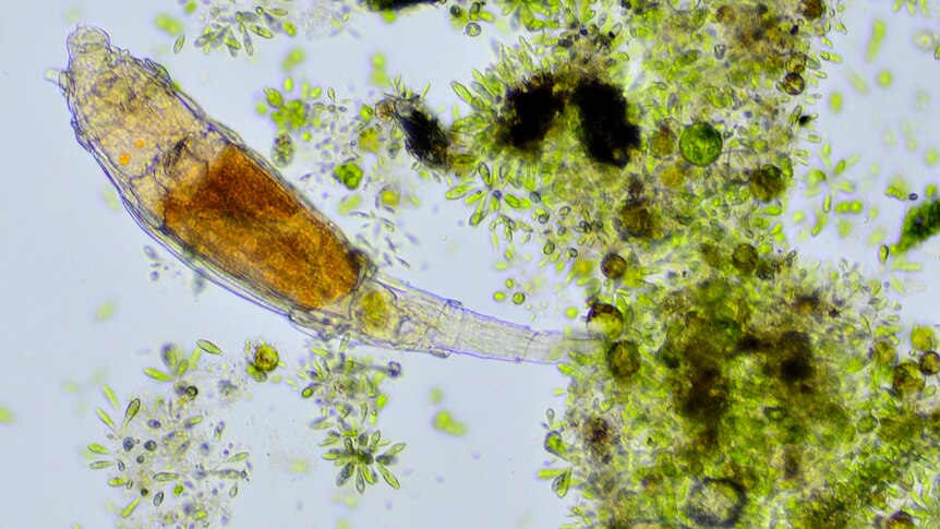 Bdelloid rotifer with algae 
