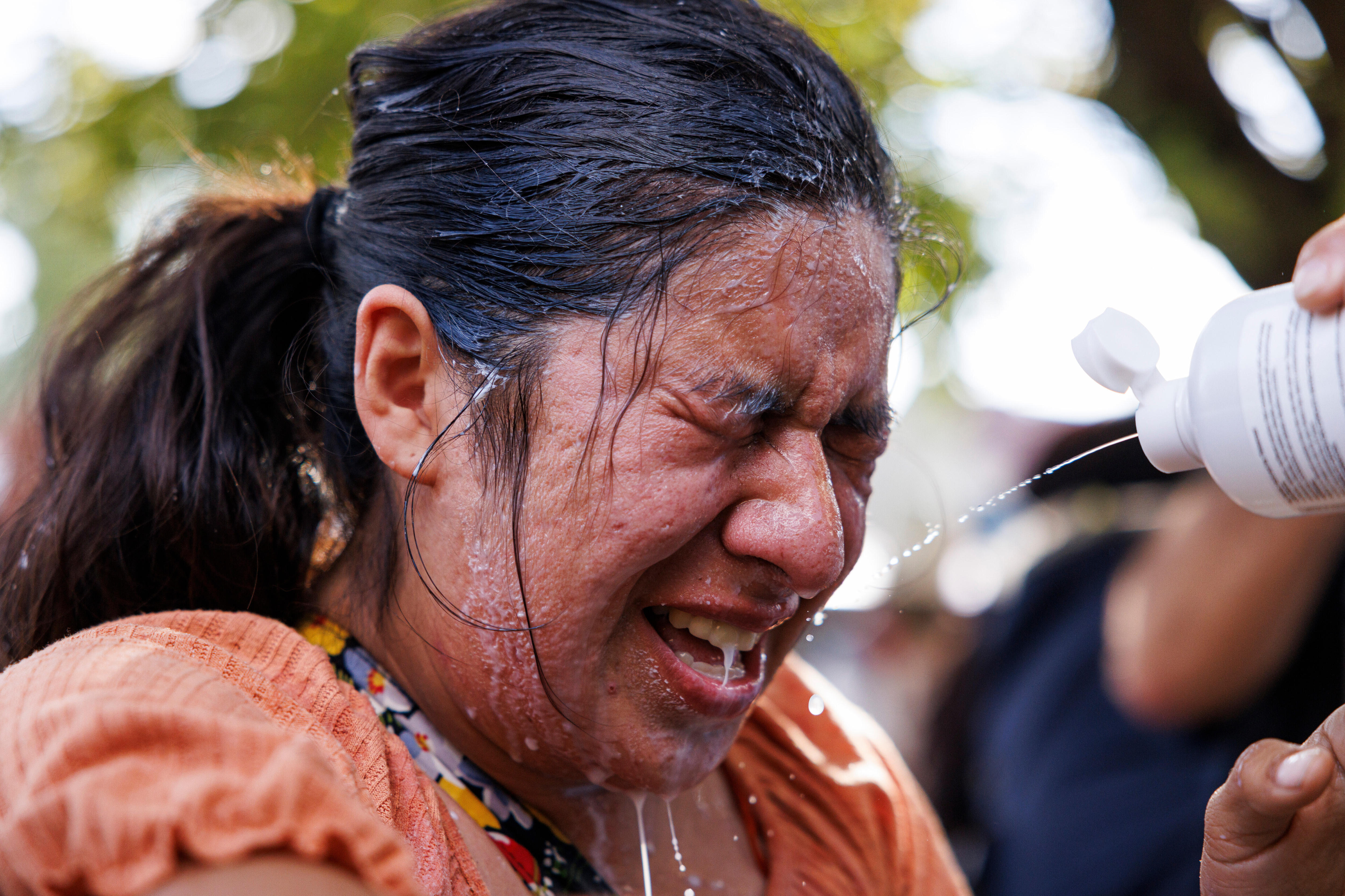 A woman of colour has her face scrunched up in pain as water is splayed over her face with a white bottle.