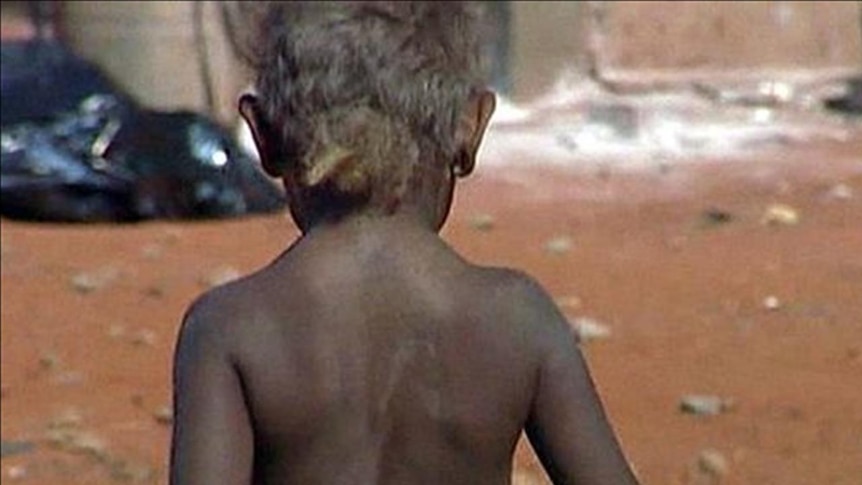 An Indigenous child in a remote Aboriginal community