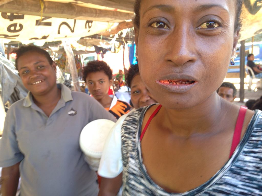 'Scared to chew' How a betel nut chewing habit nearly cost an ARIA