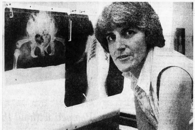 A black and white newspaper image of a woman with x-rays behind her. 