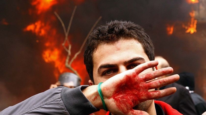 An Iranian opposition supporter covers his face with his bloodstained hand during clashes