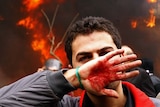 An Iranian opposition supporter covers his face with his bloodstained hand during clashes