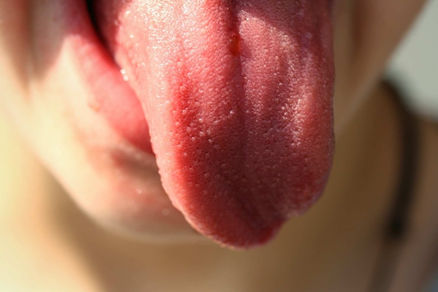 Taste buds on a tongue.