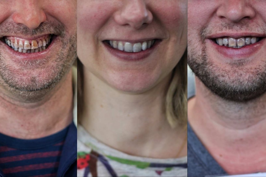 Stained teeth of judges at the Royal Melbourne Wine Awards.