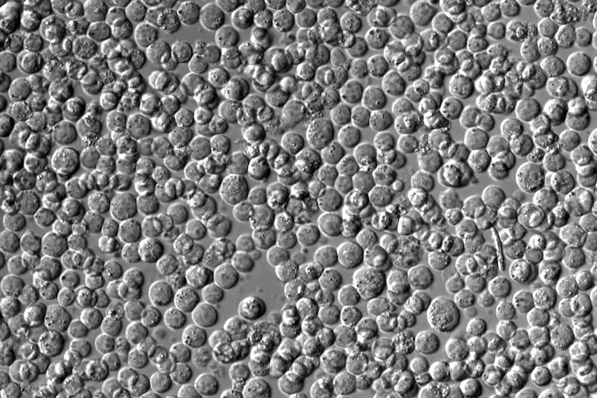 Burkitt Lymphoma cells before CRISPR