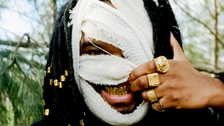 Genesis Owusu, face bandaged up, wearing gold rings, gold teeth grill and gold in his dread locs