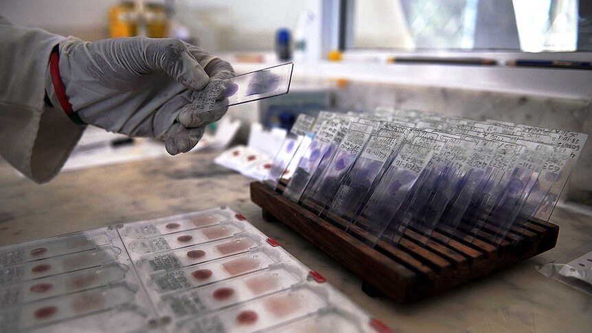 A gloved hand holds out a blood test with a malaria sample.