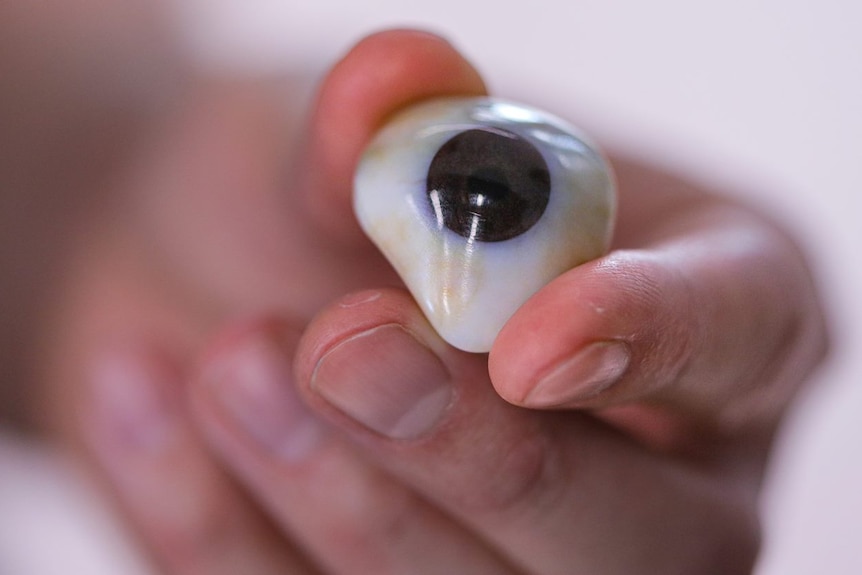 A close-up of an ocular prosthesis