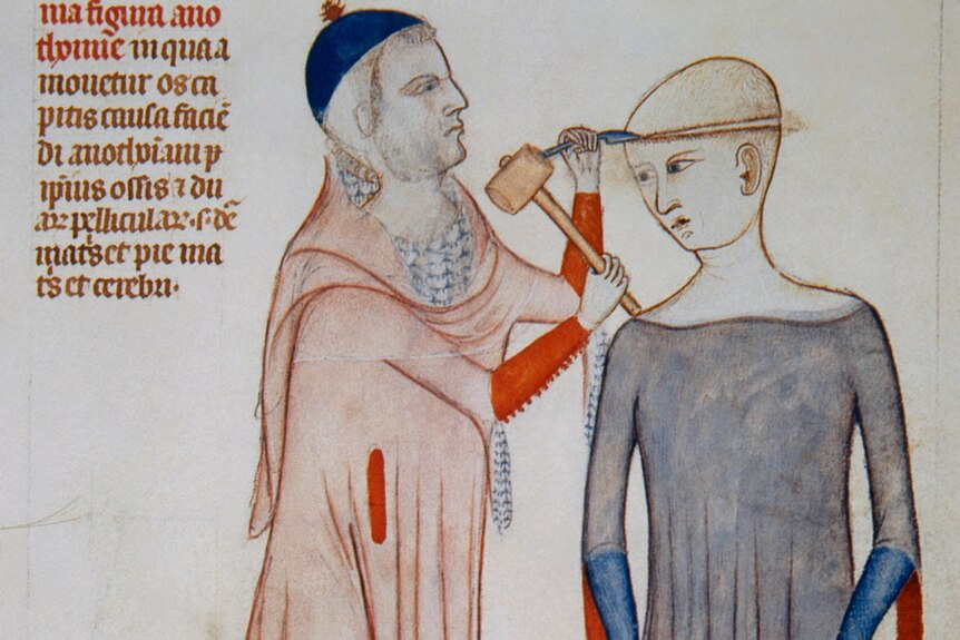 A 14th century illustration of a man hammering a knife into a person's head.