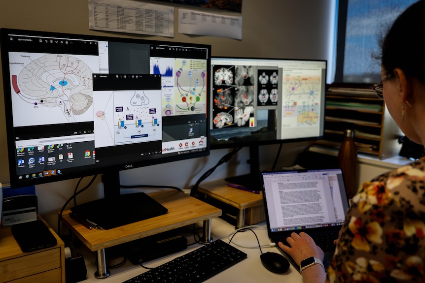 The back of Dr Elspeth Hutton looking at multiple screens with diagrams and MRI images of a brain.