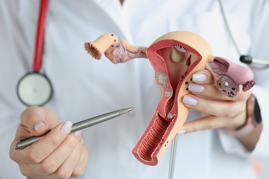 Doctor is holds model of female reproductive organs.