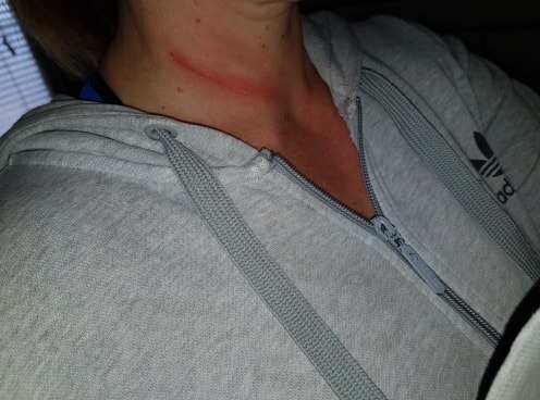 Police investigating after woman suffers neck injury caused by fishing ...