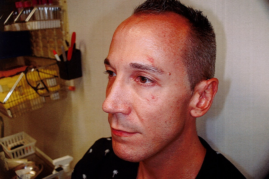 a profile shot of a man after suffering injuries