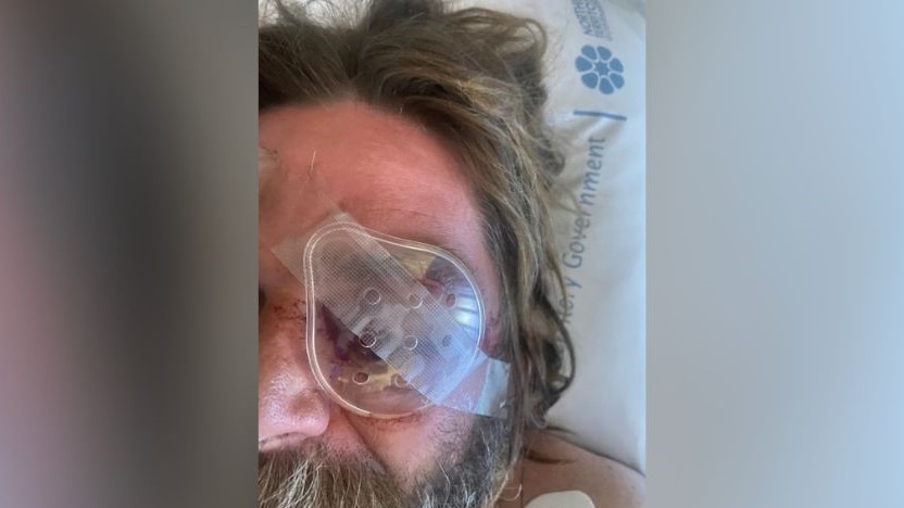 A middle-aged man with an eye injury lies in a hospital bed.