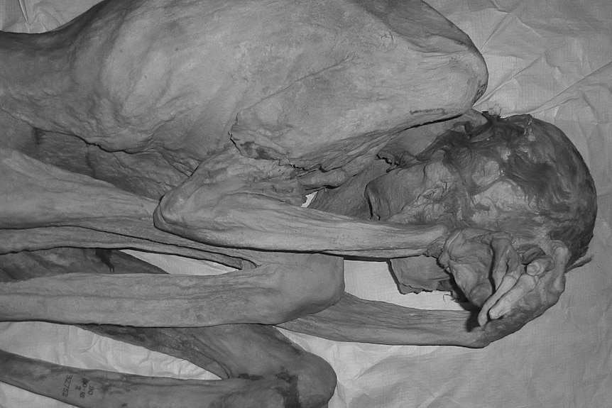 An black and white photo of the mummy of Gebelein Woman.