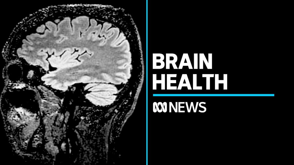 Experts praise rugby league legend for revealing dementia diagnosis ...