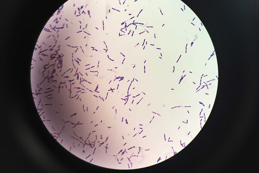 Bacillus cereus bacteria